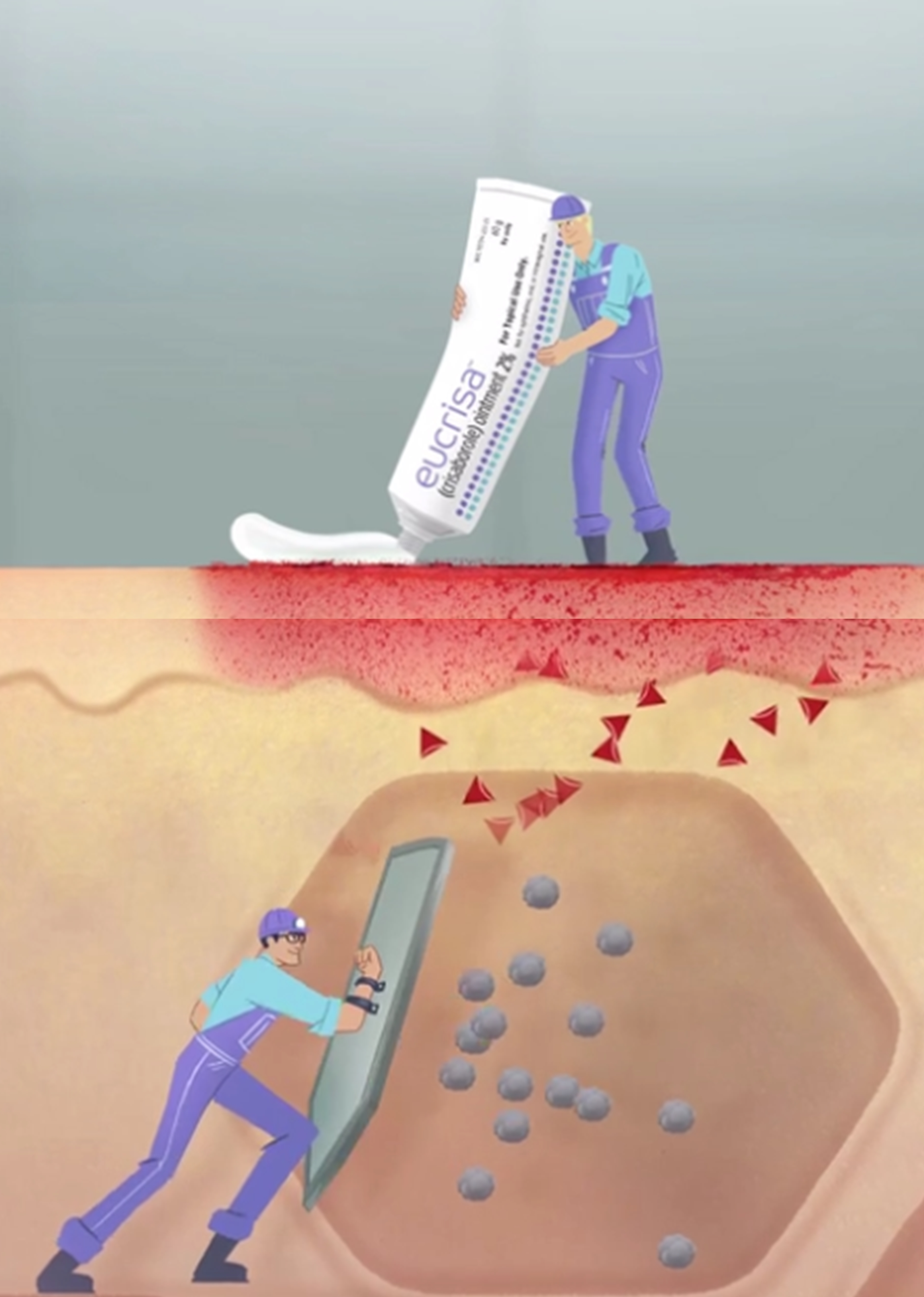 EUCRISA Eczema Ointment works Above and Below the skin at the same time